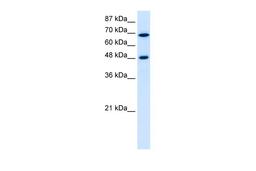 Antibody used in WB on Human Jurkat 5.0 ug/ml.