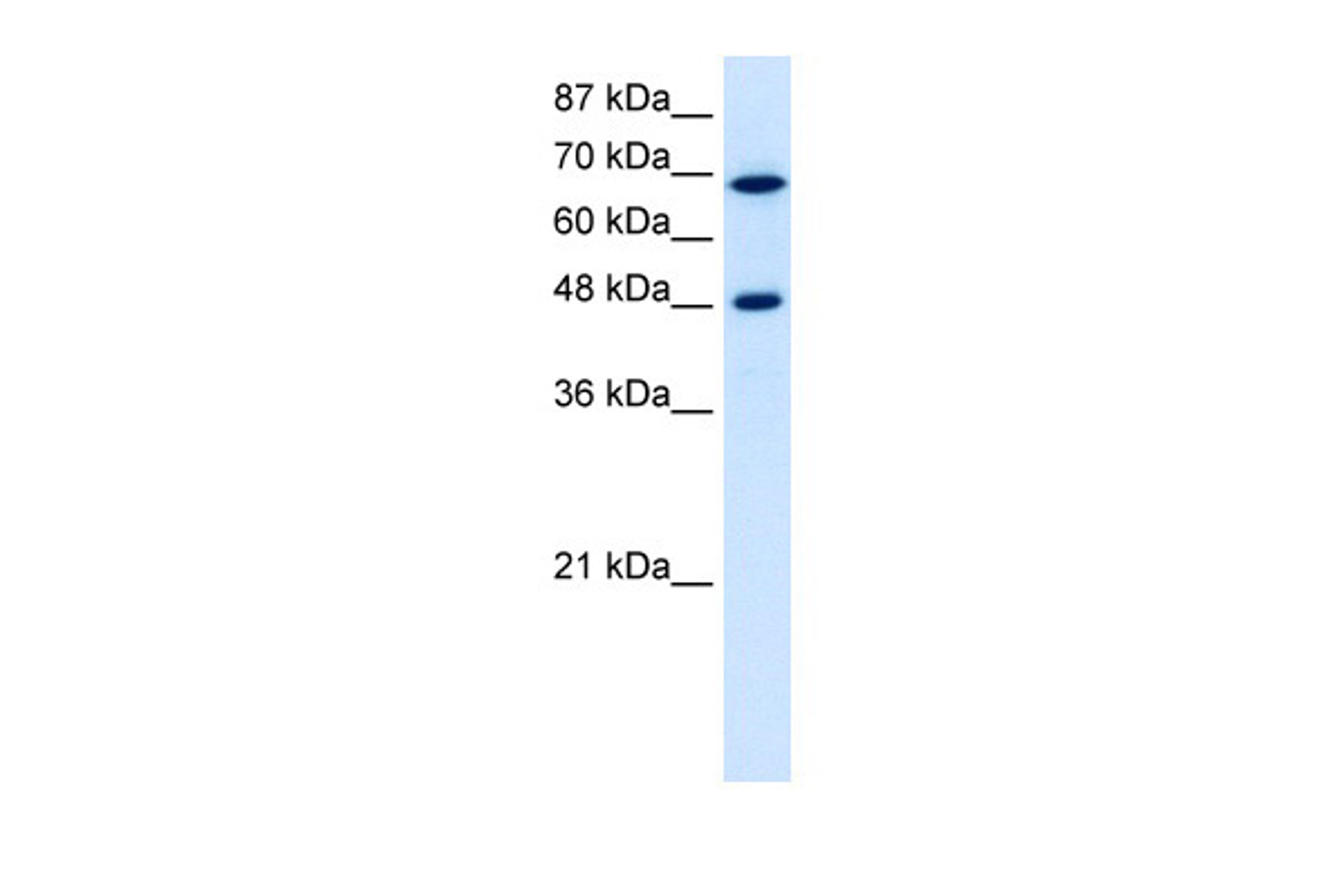 Antibody used in WB on Human Jurkat 5.0 ug/ml.