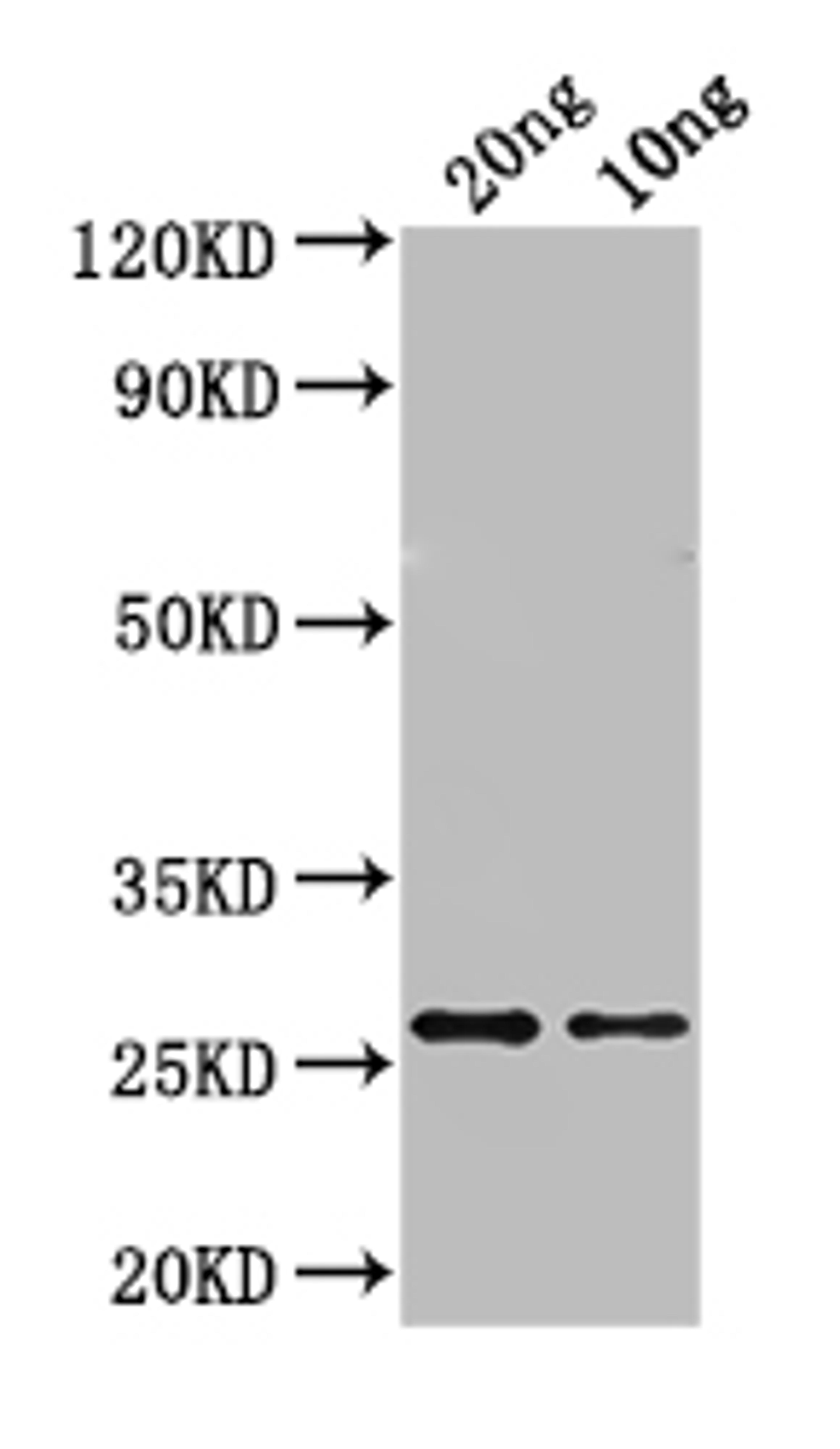 Western Blot. Positive WB detected in: recombinant protein. All lanes: ASE1 Antibody at 1:1000. Secondary. Goat polyclonal to rabbit IgG at 1/50000 dilution. Predicted band size: 27 kDa. Observed band size: 27 kDa. 