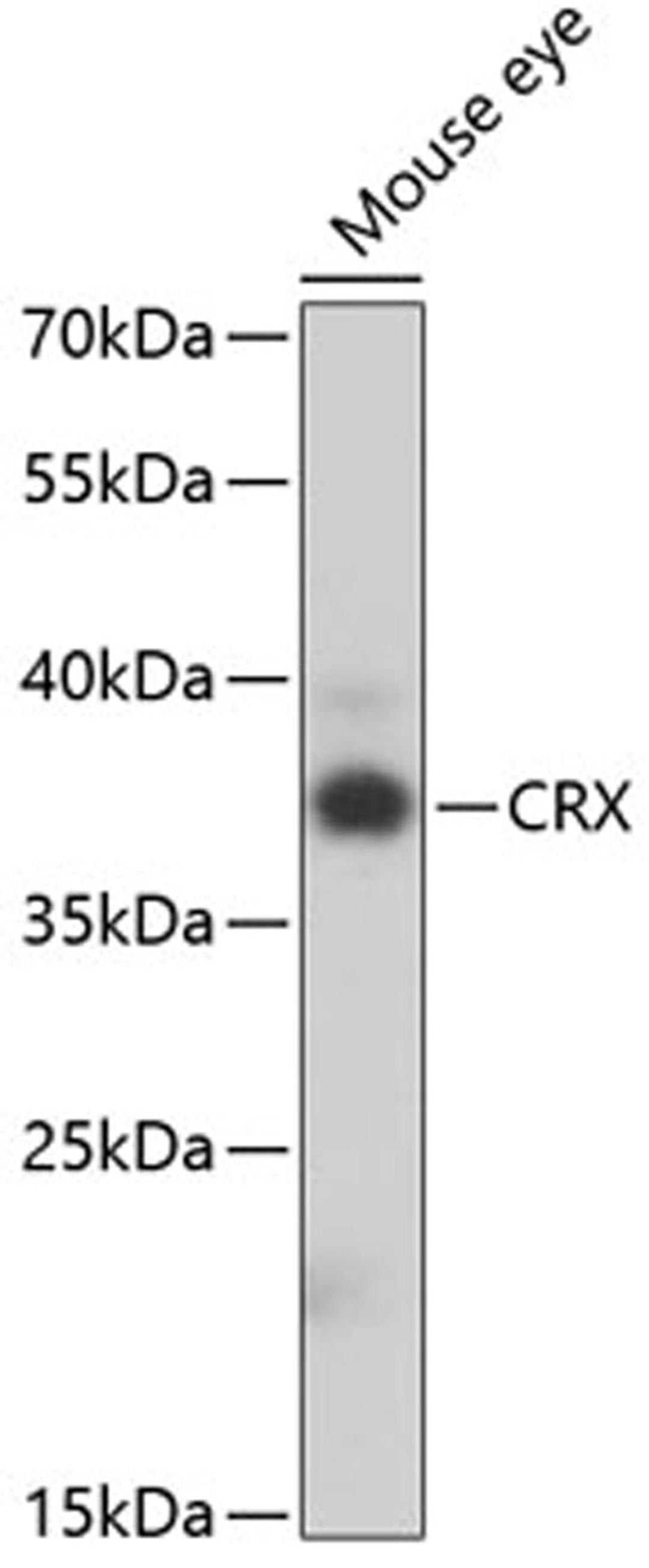 Western blot - CRX antibody (A5719)