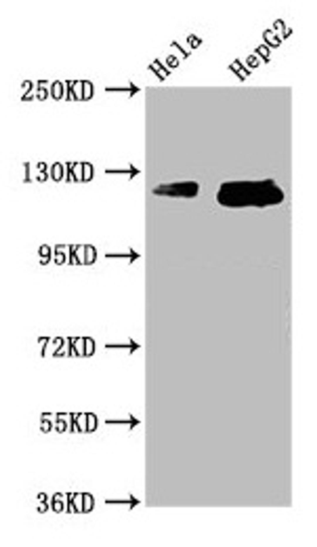 Western Blot. Positive WB detected in: Hela whole cell lysate, HepG2 whole cell lysate. All lanes: TMF1 antibody at 3.7µg/ml. Secondary. Goat polyclonal to rabbit IgG at 1/50000 dilution. Predicted band size: 123, 124 kDa. Observed band size: 123, 124 kDa