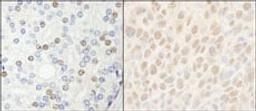 Detection of human and mouse HDAC7 by immunohistochemistry.