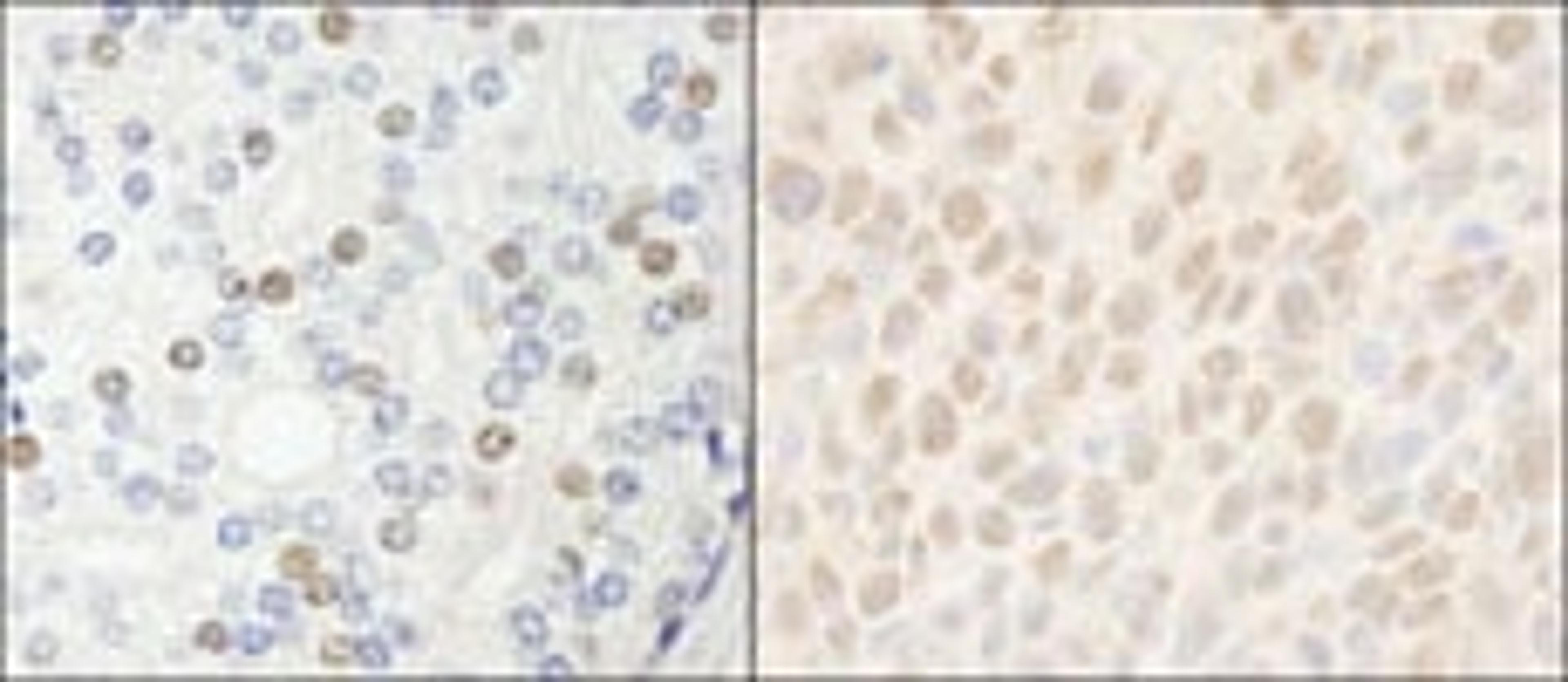 Detection of human and mouse HDAC7 by immunohistochemistry.