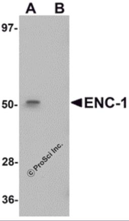 Western blot analysis of ENC-1 in mouse kidney muscle tissue lysate with ENC-1 antibody at 1 &#956;g/mL in (A) the absence and (B) the presence of blocking peptide.