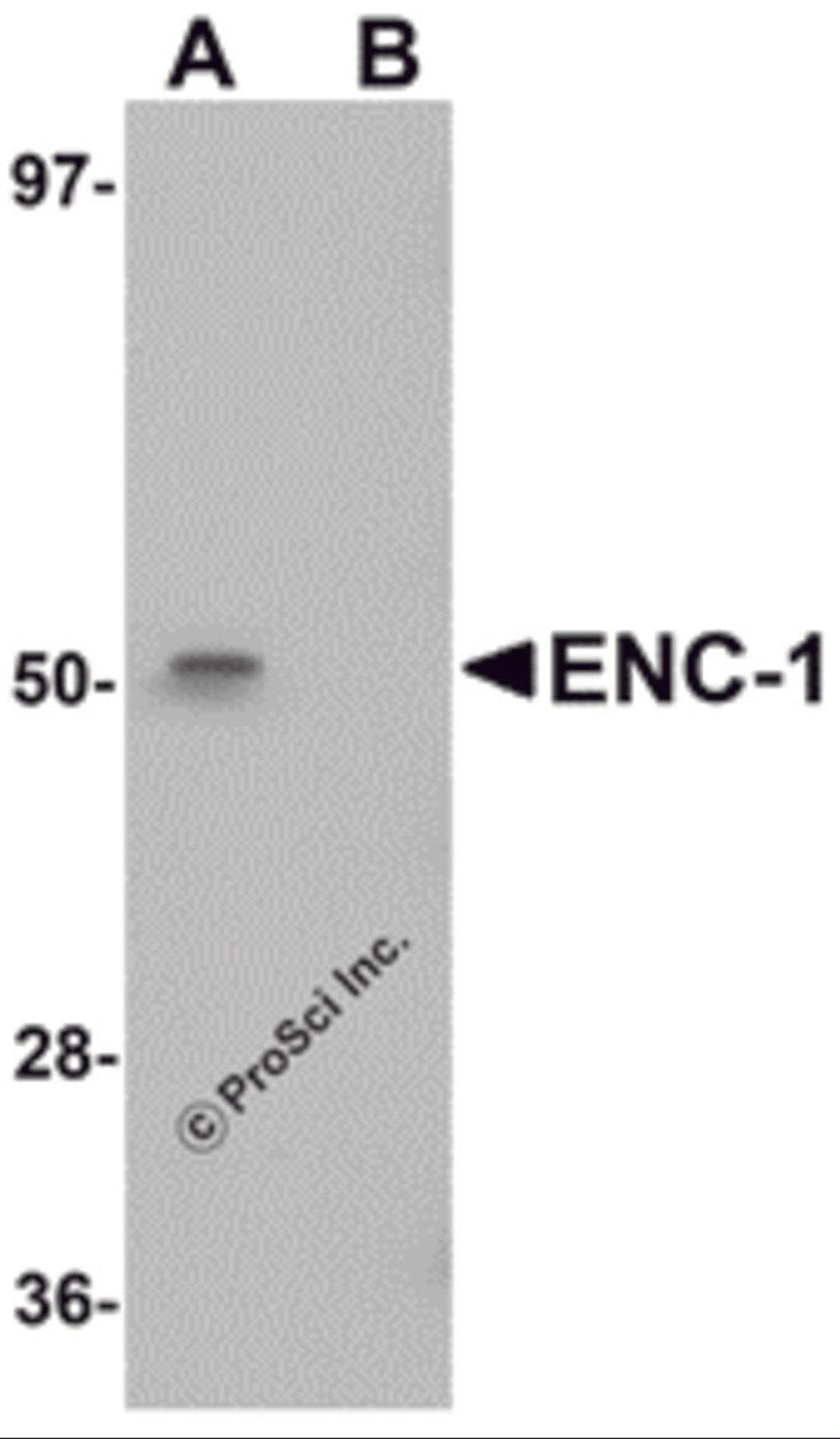 Western blot analysis of ENC-1 in mouse kidney muscle tissue lysate with ENC-1 antibody at 1 μg/mL in (A) the absence and (B) the presence of blocking peptide.