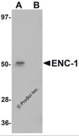 Western blot analysis of ENC-1 in mouse kidney muscle tissue lysate with ENC-1 antibody at 1 μg/mL in (A) the absence and (B) the presence of blocking peptide.