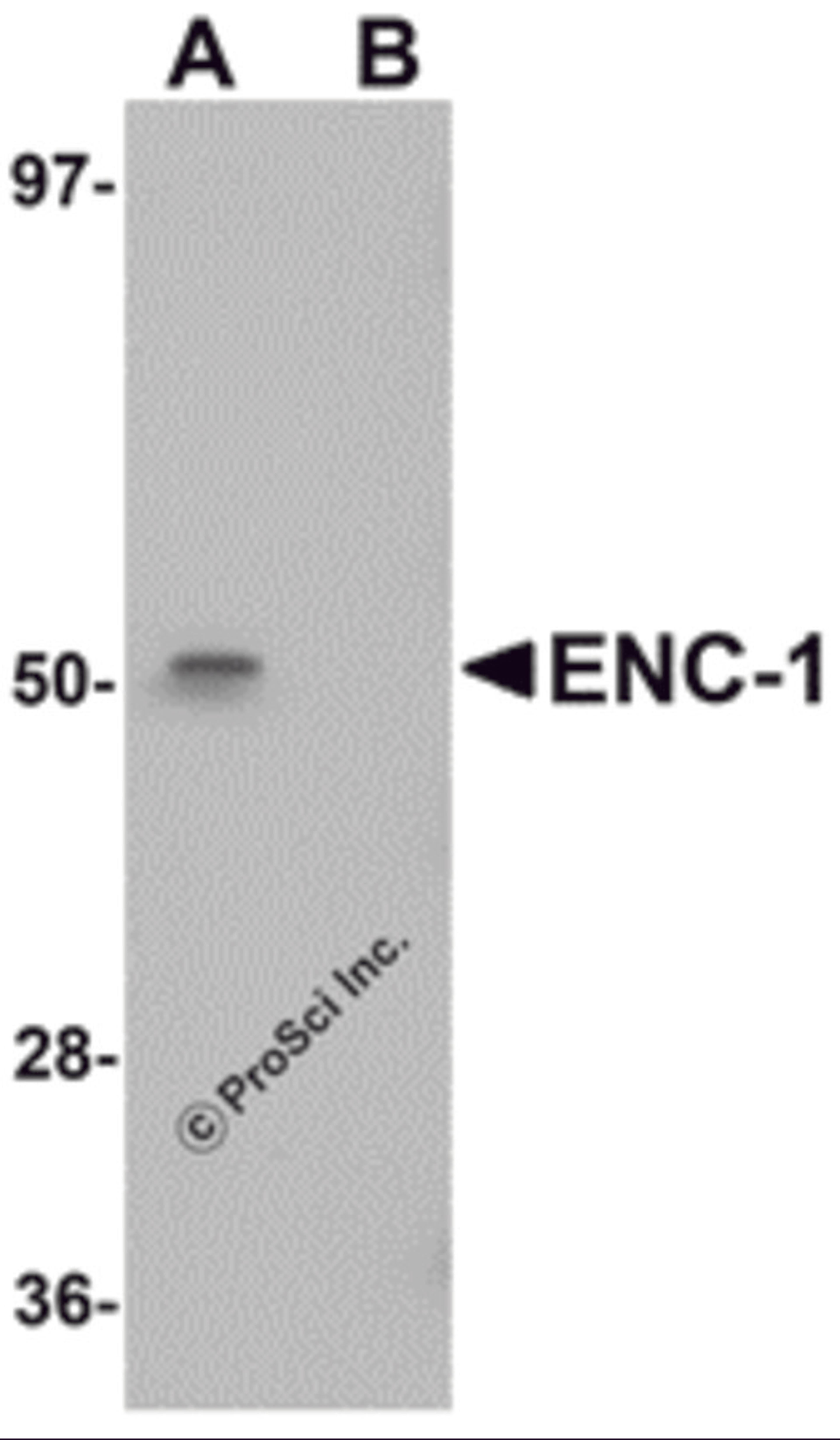 Western blot analysis of ENC-1 in mouse kidney muscle tissue lysate with ENC-1 antibody at 1 μg/mL in (A) the absence and (B) the presence of blocking peptide.