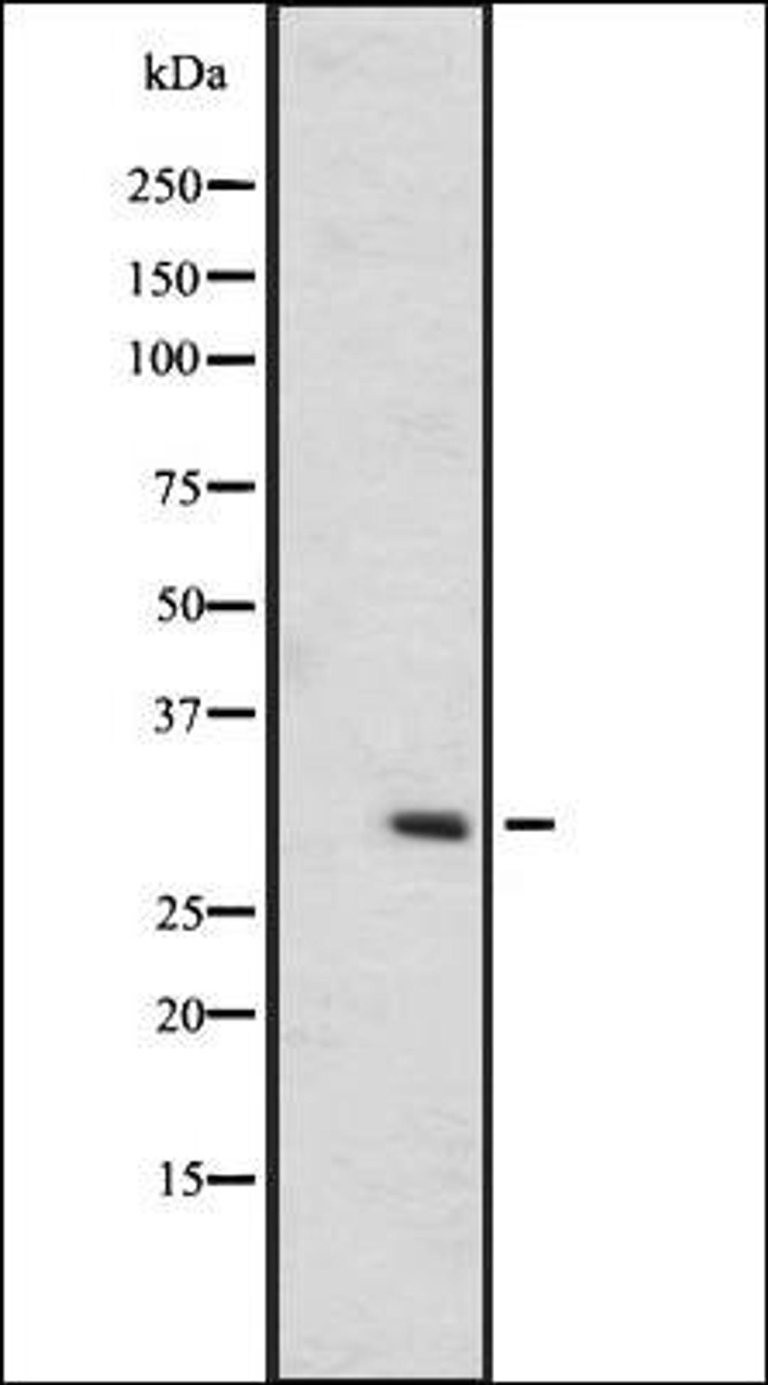 Western blot analysis of A431 whole cell lysate using OR6C75 antibody