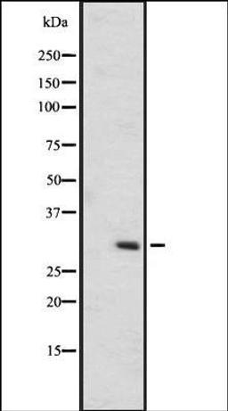 Western blot analysis of A431 whole cell lysate using OR6C75 antibody