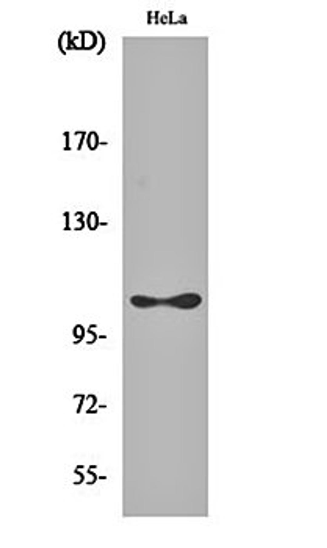 Western blot analysis of Hela cell lysates using eEF2K (phospho-S366) antibody