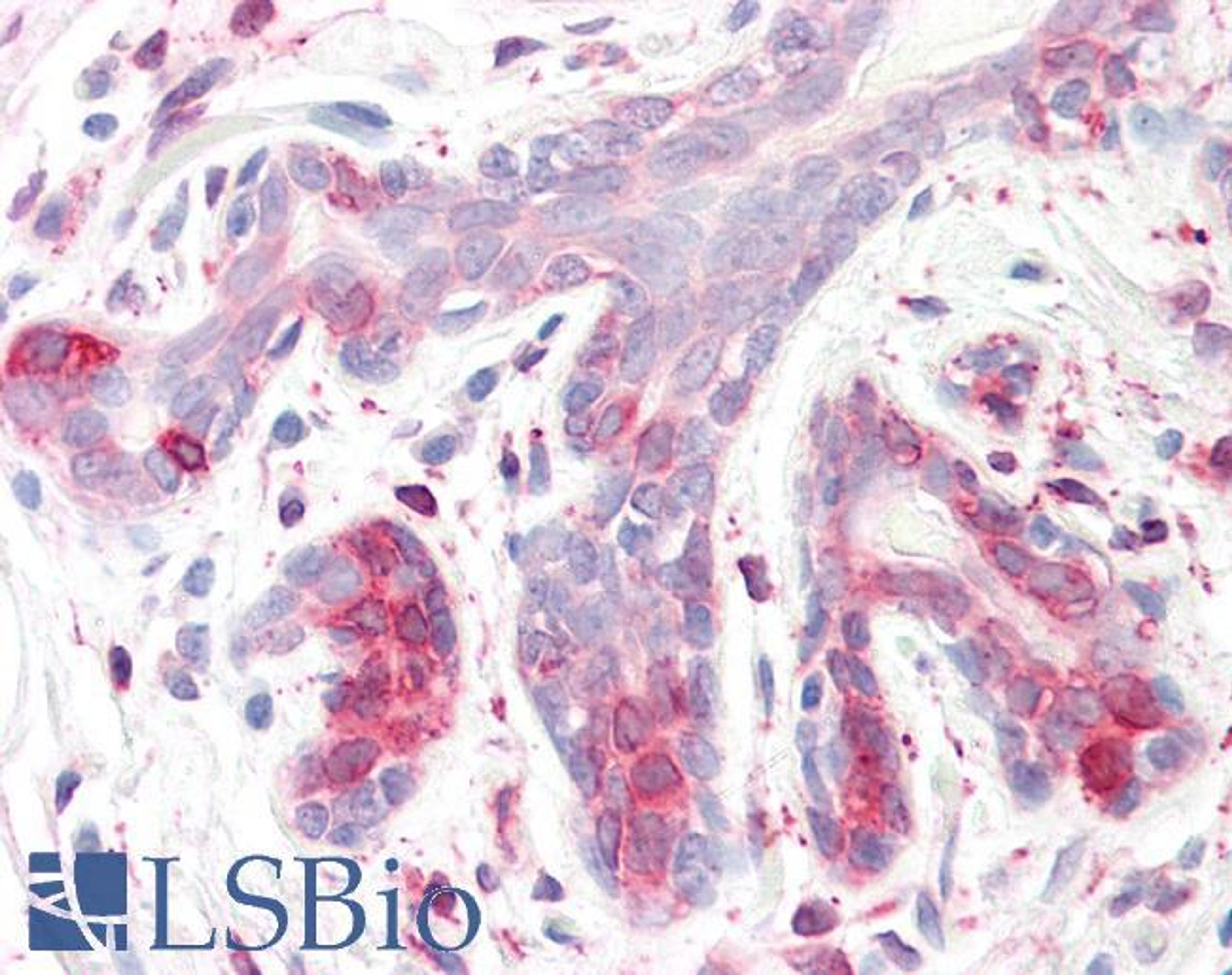 45-552 (3.75ug/ml) staining of paraffin embedded Human Breast. Steamed antigen retrieval with citrate buffer pH 6, AP-staining.