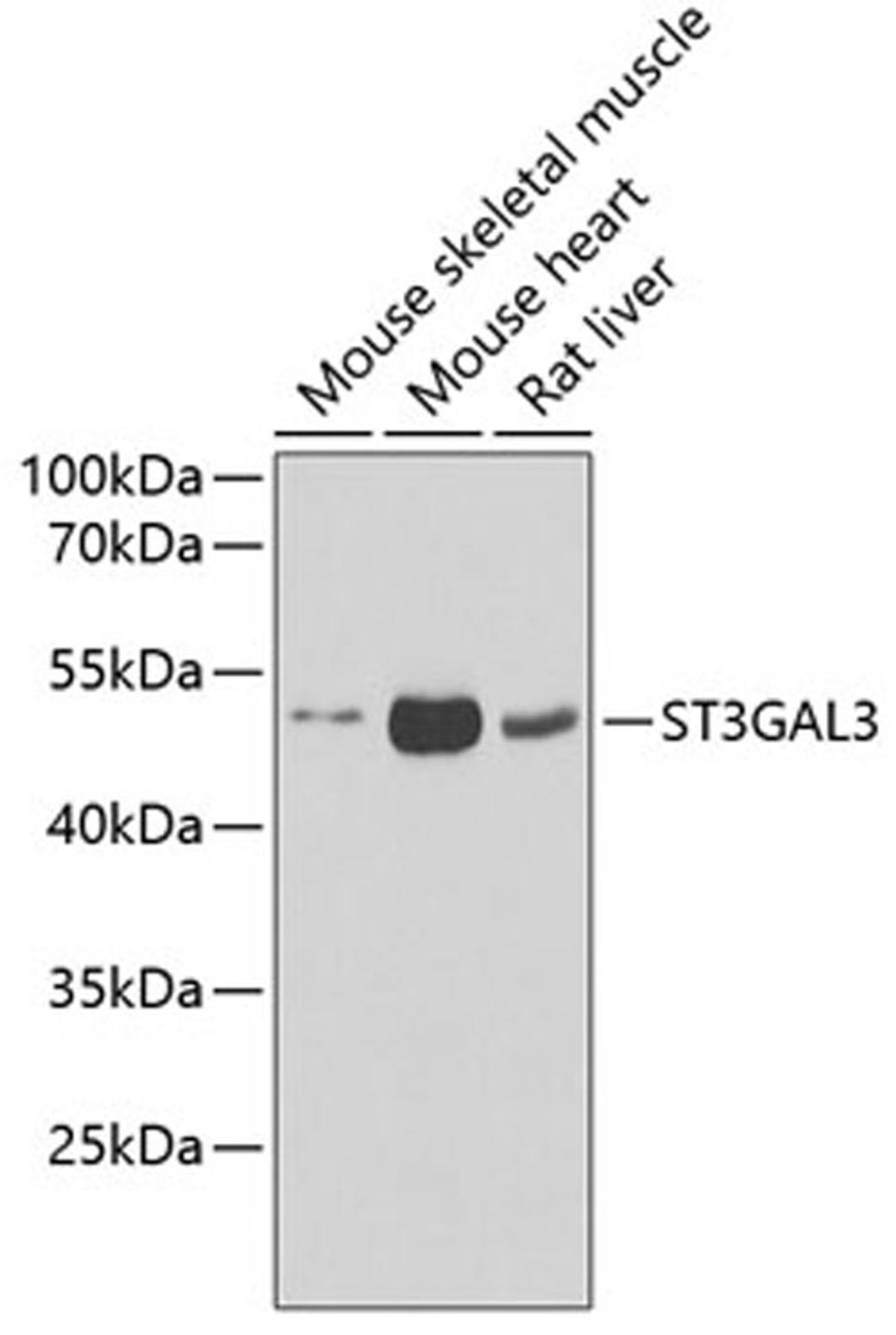 Western blot - ST3GAL3 antibody (A6753)