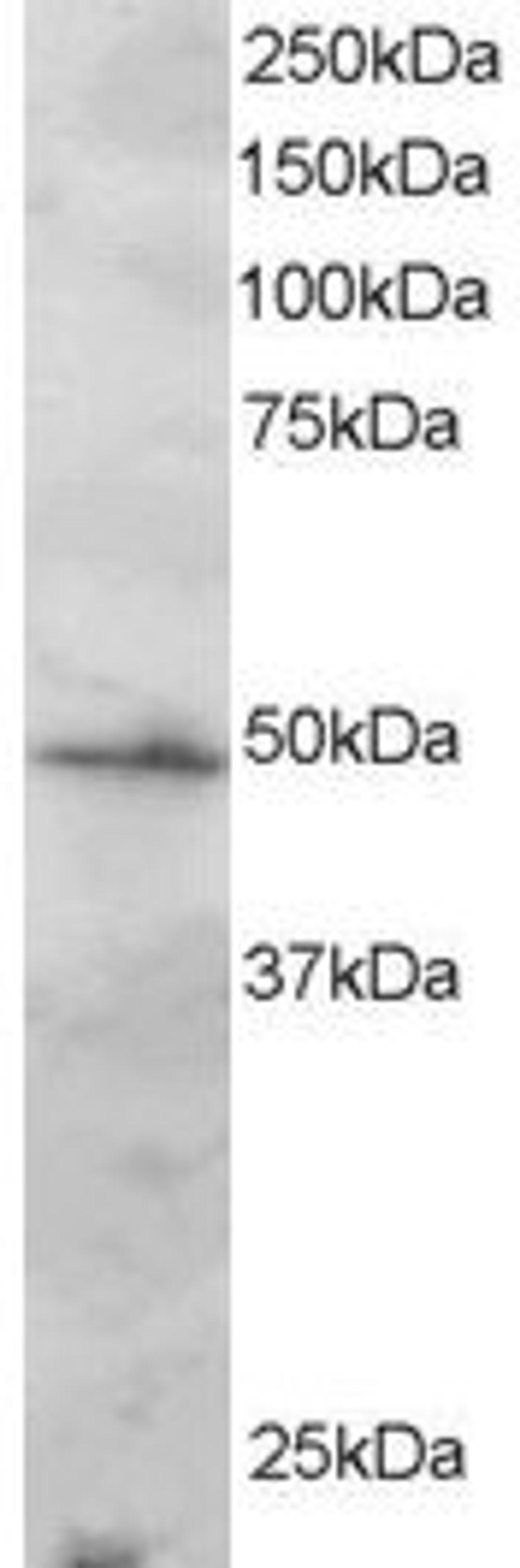 45-780 staining (2ug/ml) of Jurkat lysate (RIPA buffer, 30ug total protein per lane). Primary incubated for 1 hour. Detected by western blot using chemiluminescence.