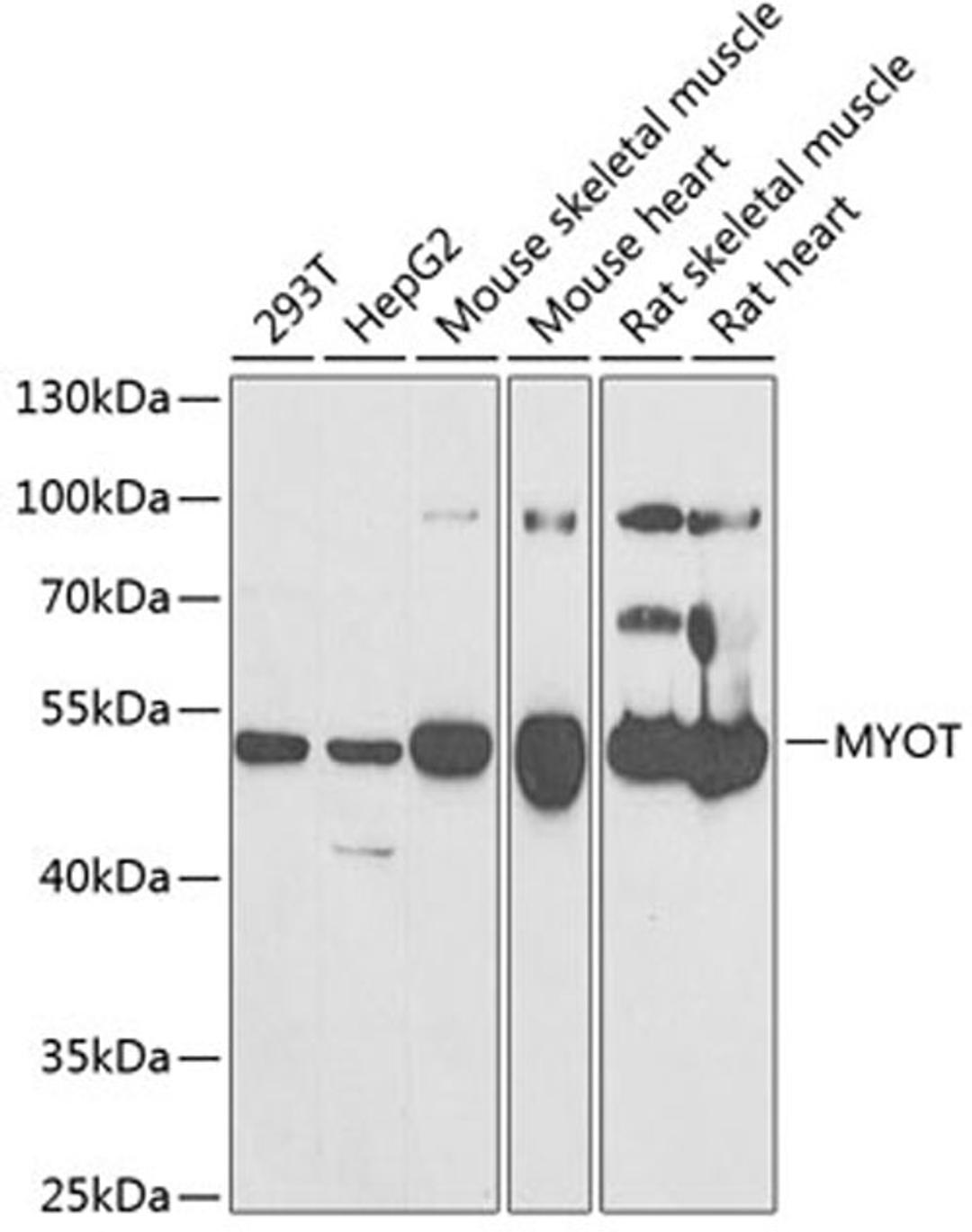 Western blot - MYOT antibody (A6439)