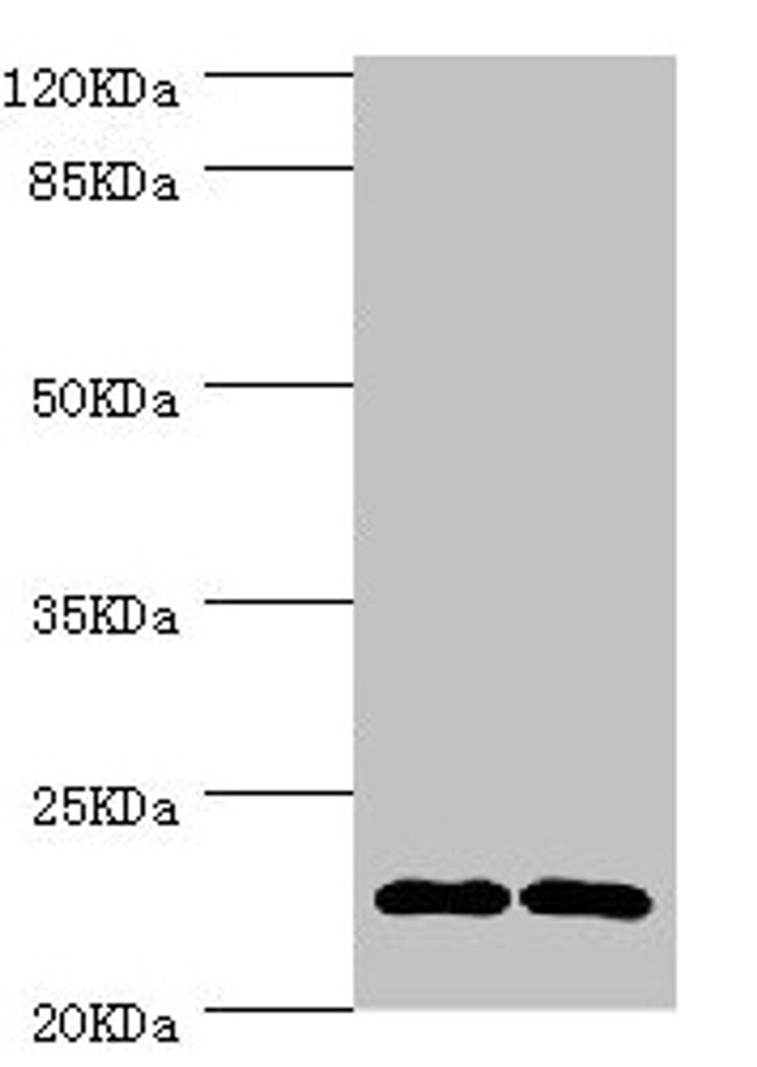 Western blot. All lanes: CMPK1 antibody at 3.55µg/ml. Lane 1: 293T whole cell lysate. Lane 2: Hela whole cell lysate. Secondary. Goat polyclonal to rabbit IgG at 1/10000 dilution. Predicted band size: 23, 17 kDa. Observed band size: 23 kDa