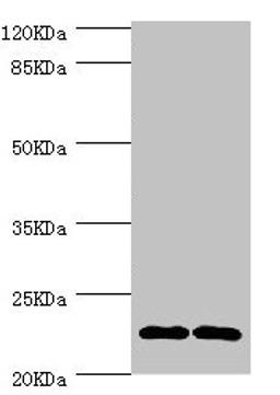 Western blot. All lanes: CMPK1 antibody at 3.55µg/ml. Lane 1: 293T whole cell lysate. Lane 2: Hela whole cell lysate. Secondary. Goat polyclonal to rabbit IgG at 1/10000 dilution. Predicted band size: 23, 17 kDa. Observed band size: 23 kDa