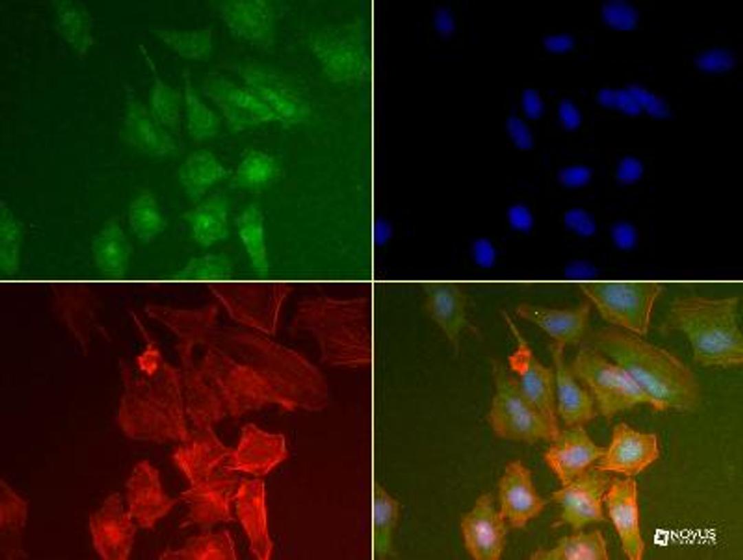 Immunocytochemistry/Immunofluorescence: PABP Antibody (10E10) [NB120-6125] - PABP antibody was tested in HeLa cells at a 1:50 dilution using a Dylight 488 conjugated secondary antibody (Green). Actin (Red) and DNA (Blue) were counterstained using Phalloidin 568 and DAPI.