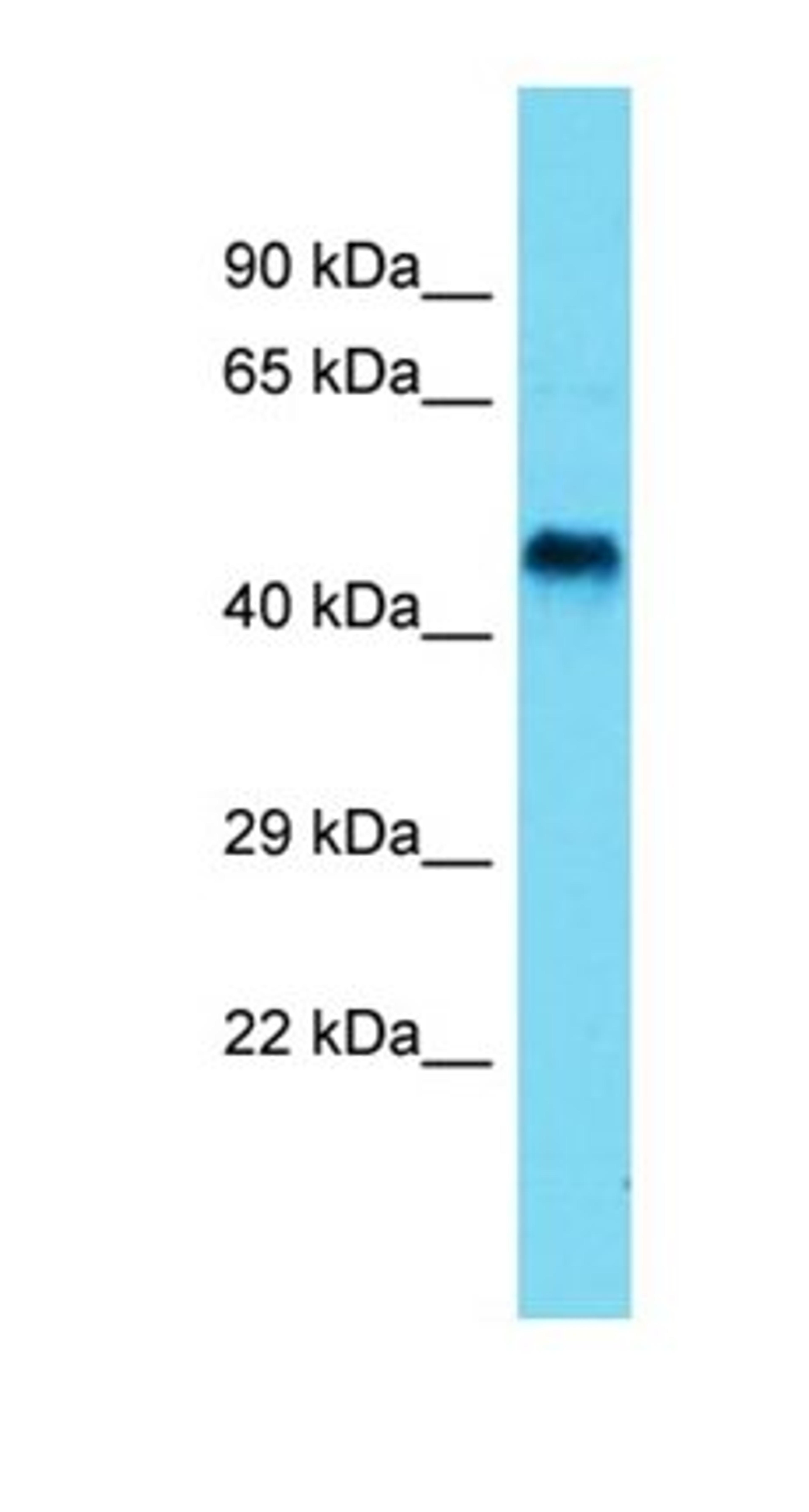 Western blot analysis of rat Small Intestine tissue using Seli antibody