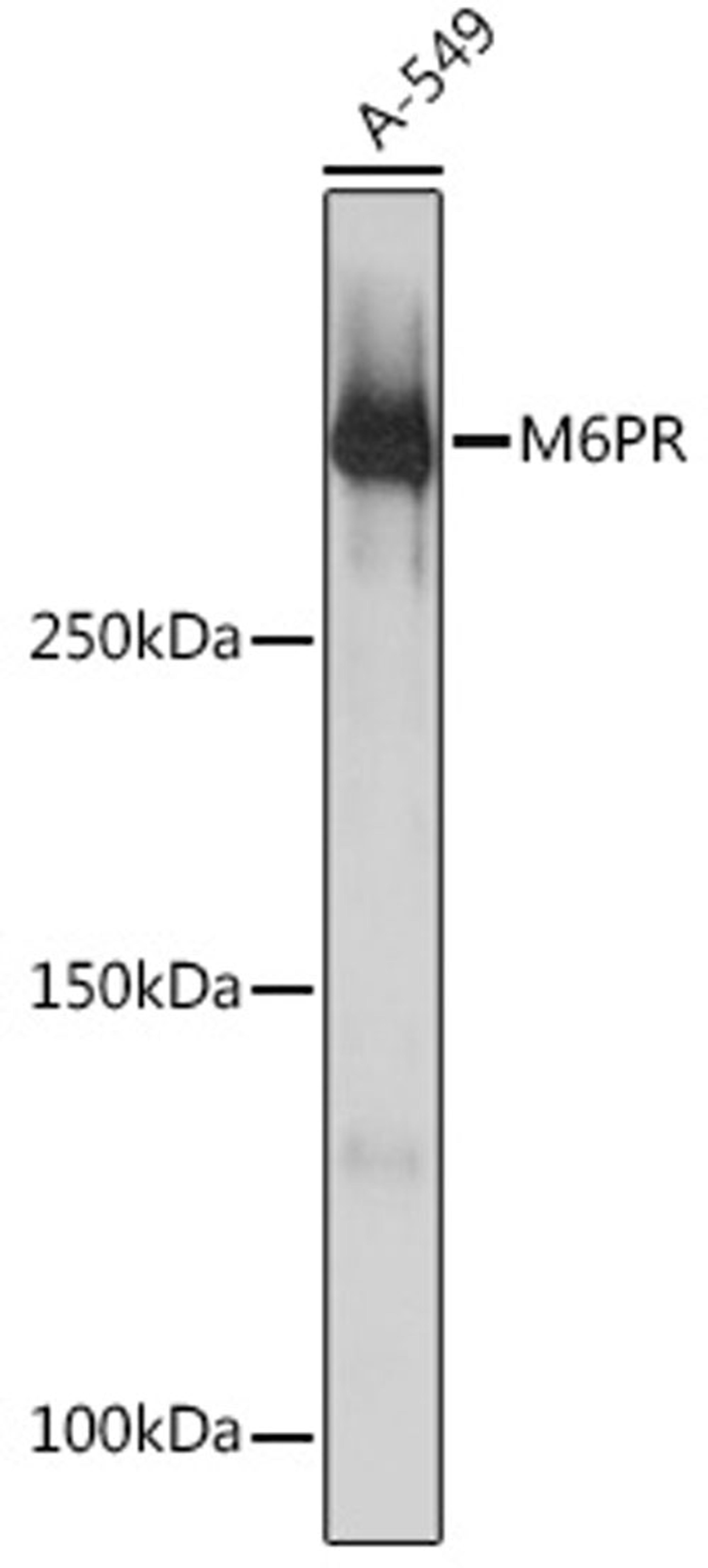 Western blot - M6PR Rabbit mAb (A3762)