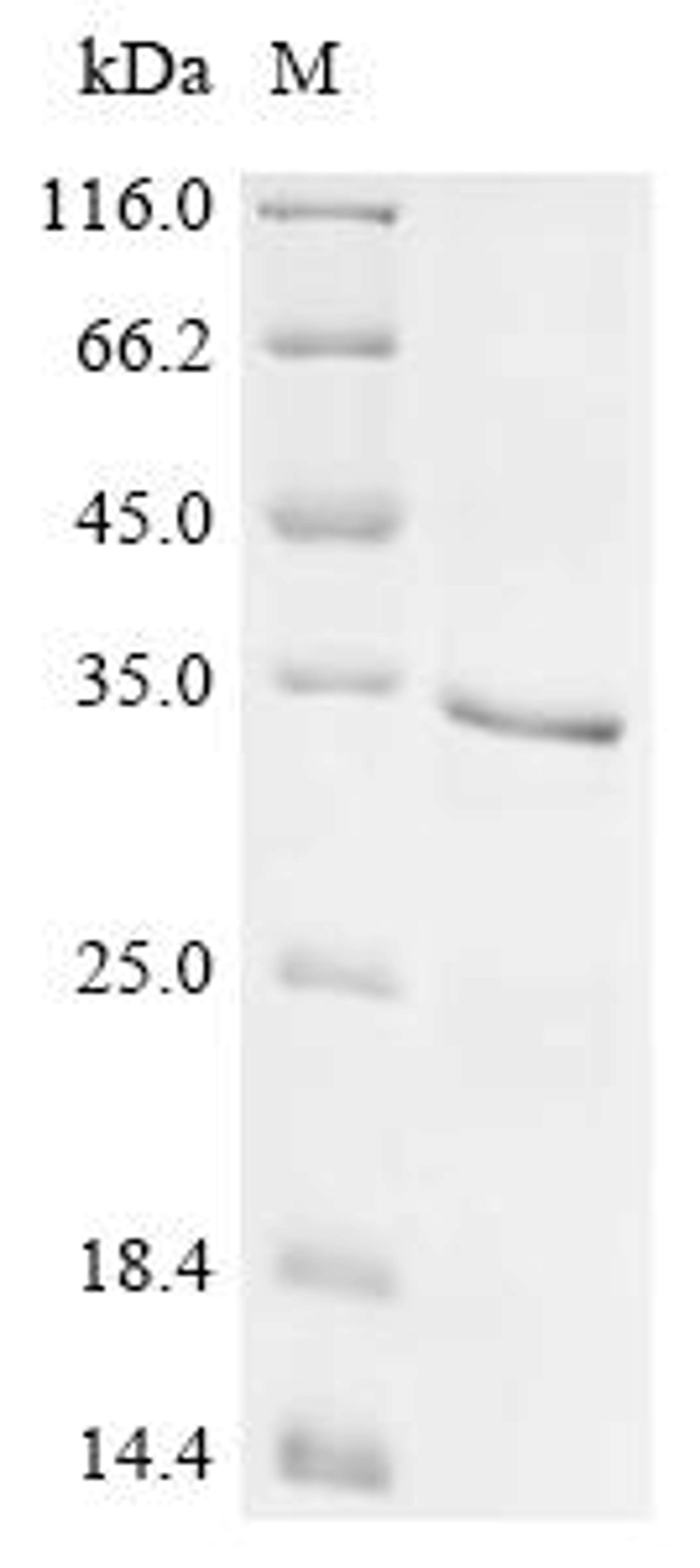 (Tris-Glycine gel) Discontinuous SDS-PAGE (reduced) with 5% enrichment gel and 15% separation gel.