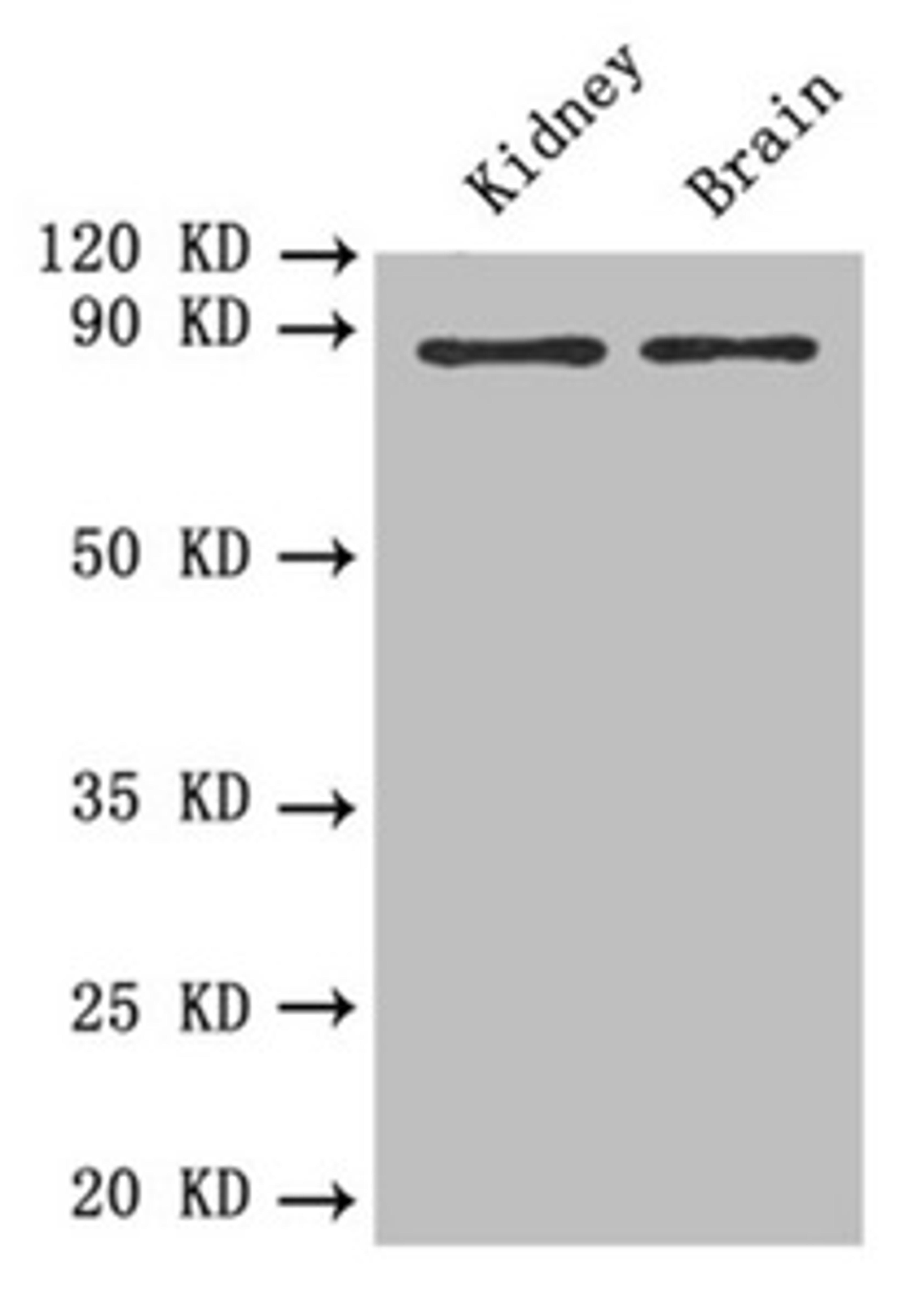 Western blot. All lanes: PTPRE antibody at 0.6 ug/ml. Lane 1: Mouse kidney tissue. Lane 2: Mouse brain tissue. Secondary. Goat polyclonal to rabbit IgG at 1/10000 dilution. Predicted band size: 81, 75, 72 kDa. Observed band size: 81 kDa.