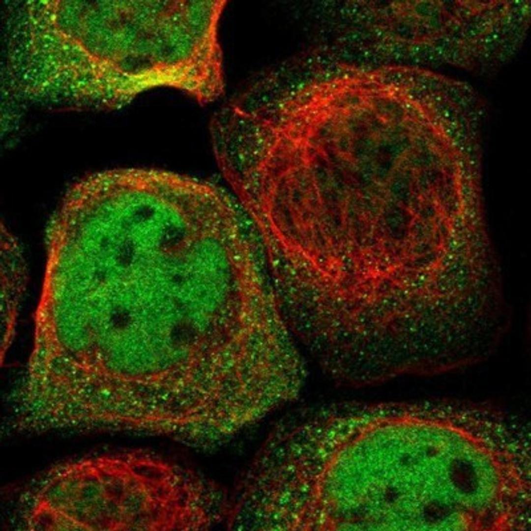 Immunocytochemistry/Immunofluorescence: hnRNP H2 Antibody [NBP1-89816] - Staining of human cell line A-431 shows positivity in nucleus but not nucleoli & cytoplasm.