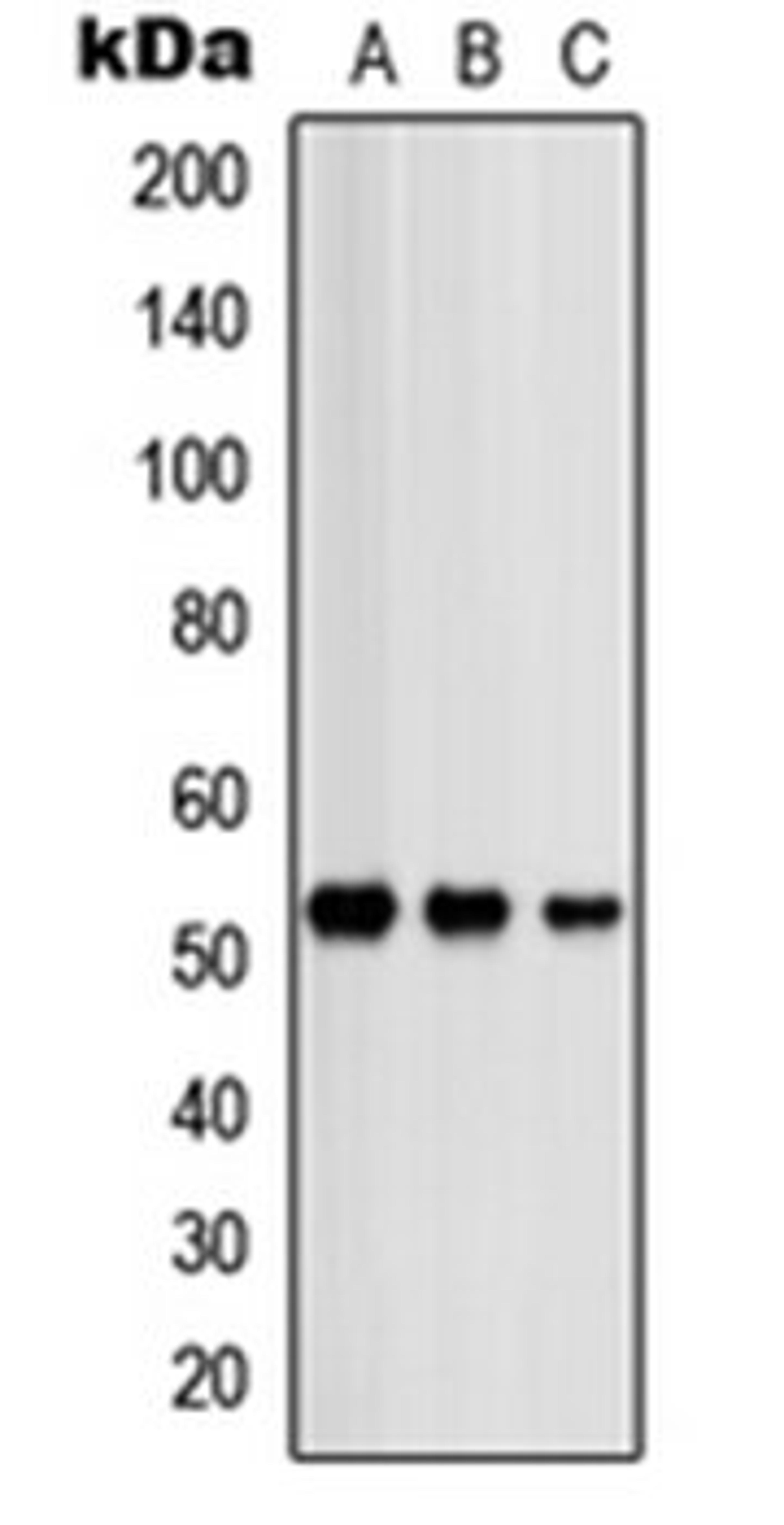 Western blot analysis of HeLa (Lane 1), SHSY5Y (Lane 2), NIH3T3 (Lane 3) whole cell lysates using PRKAR2B antibody