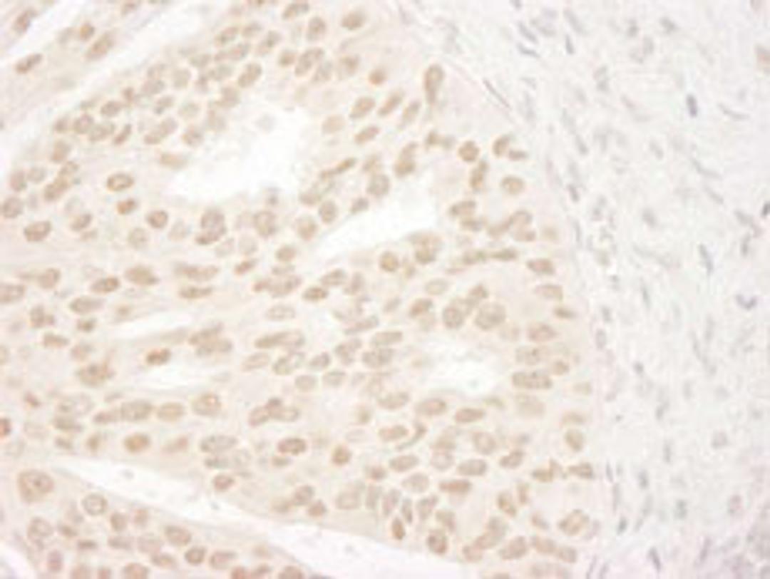 Detection of human ANKRD28/PITK by immunohistochemistry.