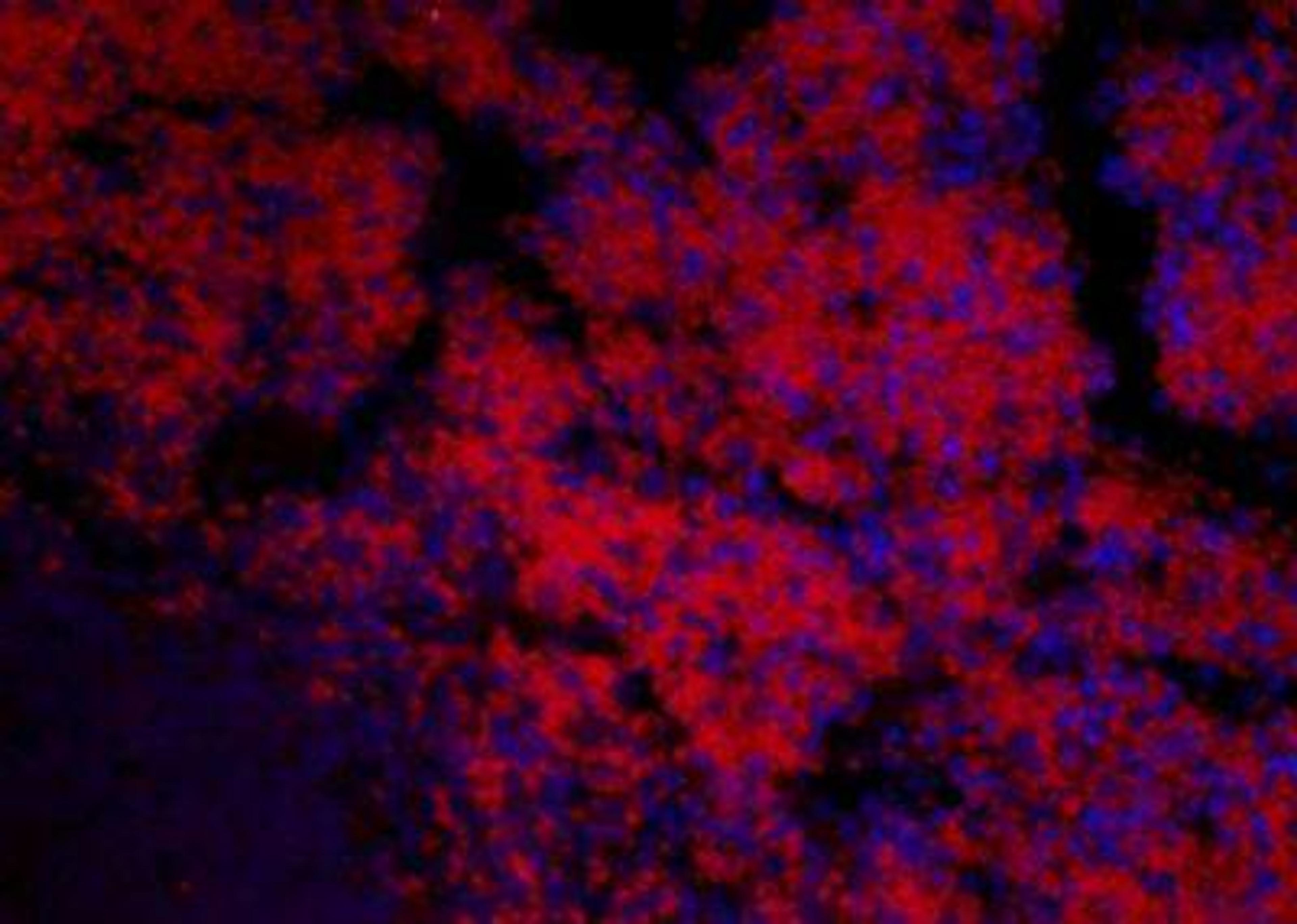 Immunohistochemical staining of mouse spleen tissue using Stabilin 2 antibody.