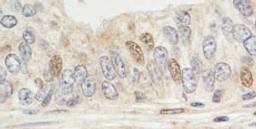 Detection of human Sin1 by immunohistochemistry.