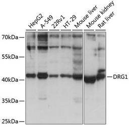 Western blot - DRG1 antibody (A3987)