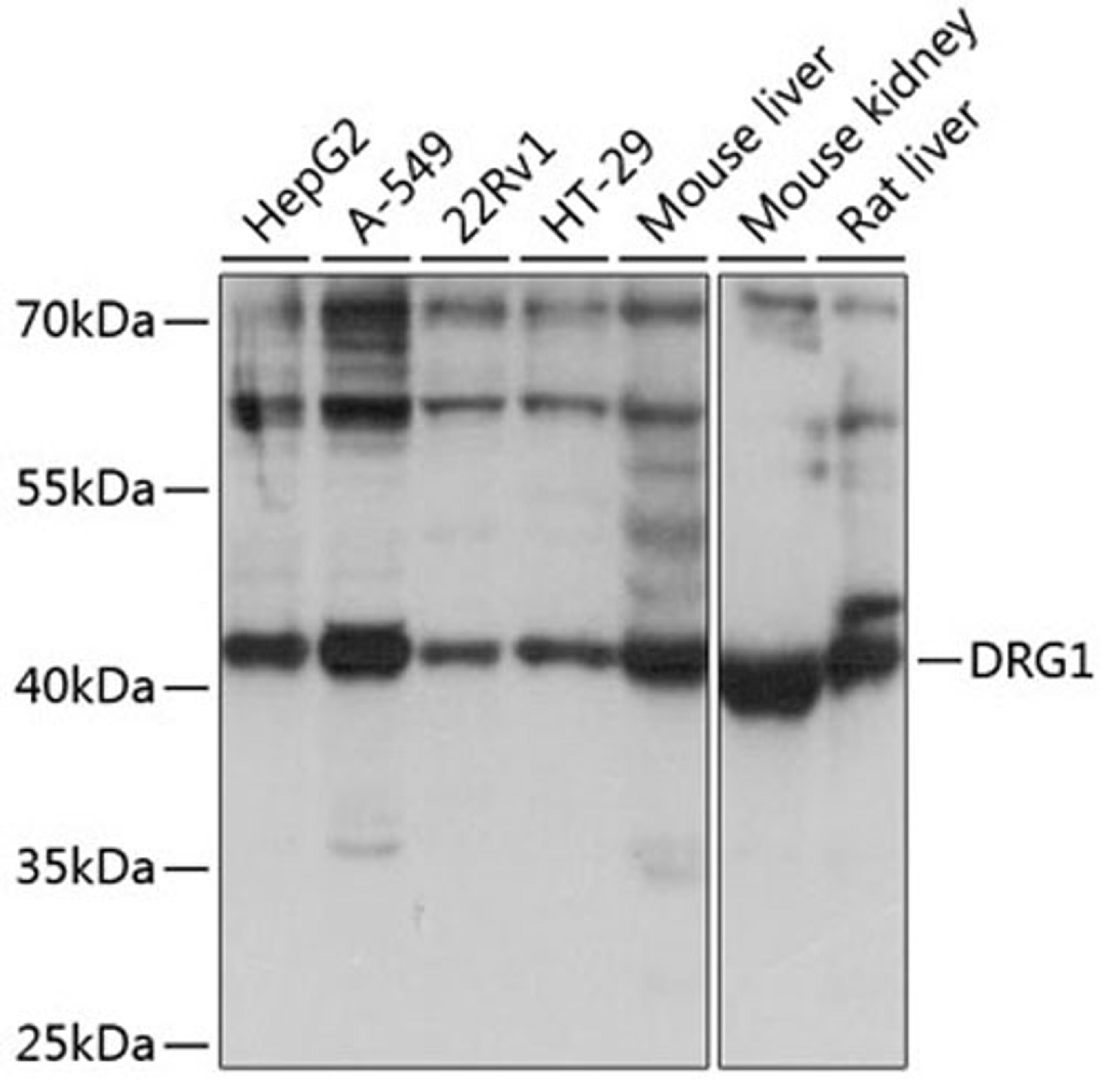 Western blot - DRG1 antibody (A3987)