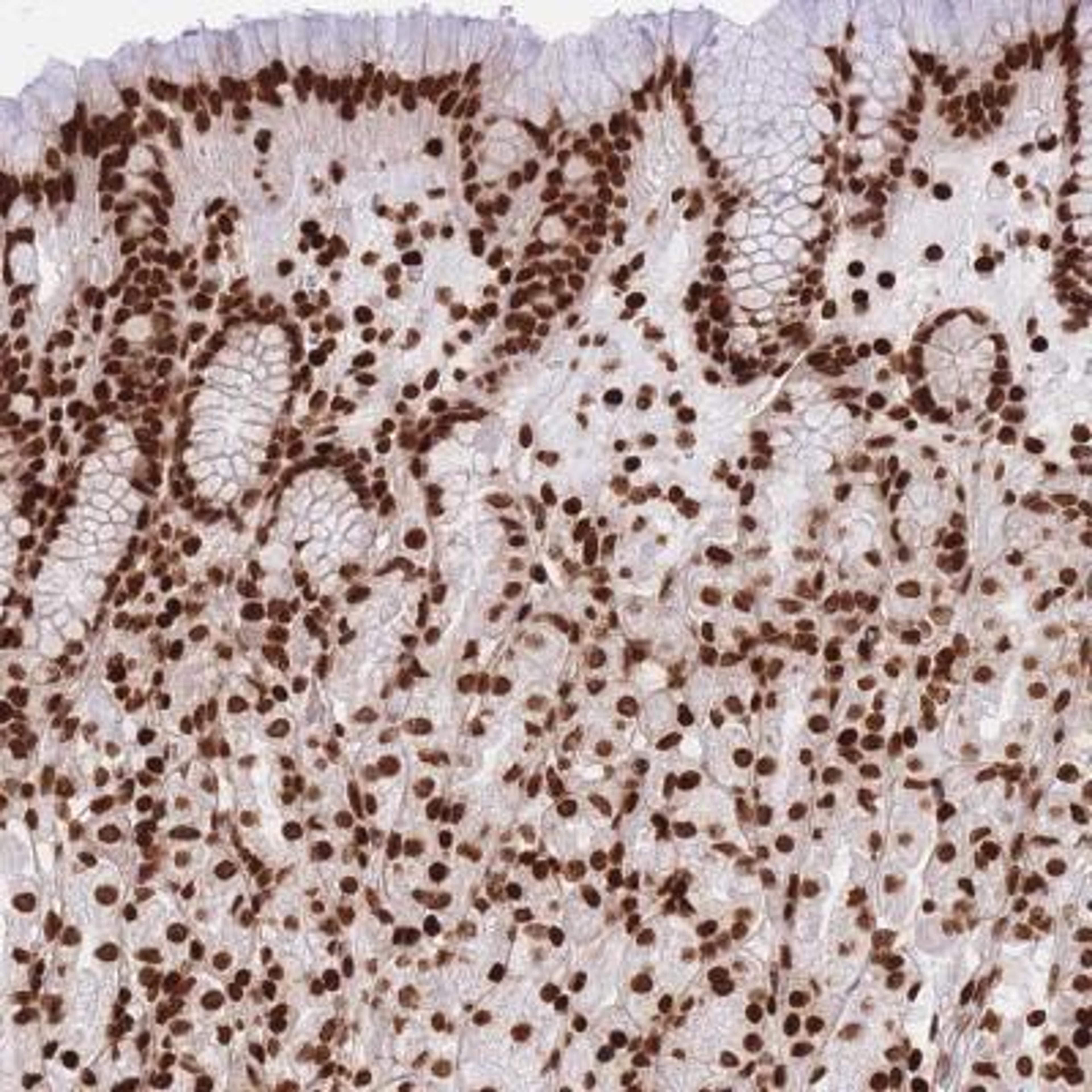 Immunohistochemistry: Histone H2B type 1B Antibody [NBP2-46688] - Analysis  of human stomach, upper shows strong nuclear positivity in glandular cells.