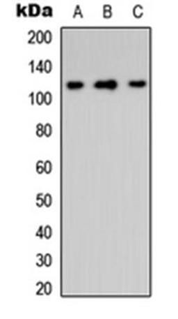 Western blot analysis of HeLa (Lane1), Raw264.7 (Lane2), PC12 (Lane3) whole cell using Integrin alpha 8 HC antibody