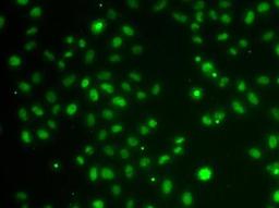 Immunofluorescense analysis of MCF7 cell using POU6F1 antibody