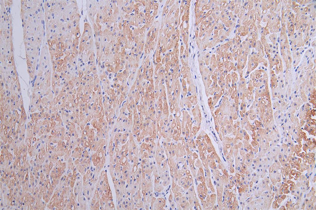 IHC image of CSB-RA058699A0HU diluted at 1:50 and staining in paraffin-embedded human heart tissue performed on a Leica BondTM system. After dewaxing and hydration, antigen retrieval was mediated by high pressure in a citrate buffer (pH 6.0). Section was blocked with 10% normal goat serum 30min at RT. Then primary antibody (1% BSA) was incubated at 4°C overnight. The primary is detected by a Goat anti-rabbit polymer IgG labeled by HRP and visualized using 0.16% DAB.