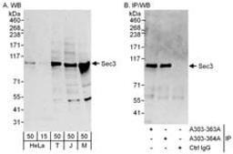 Detection of human and mouse Sec3 by western blot (h and m) and immunoprecipitation (h).