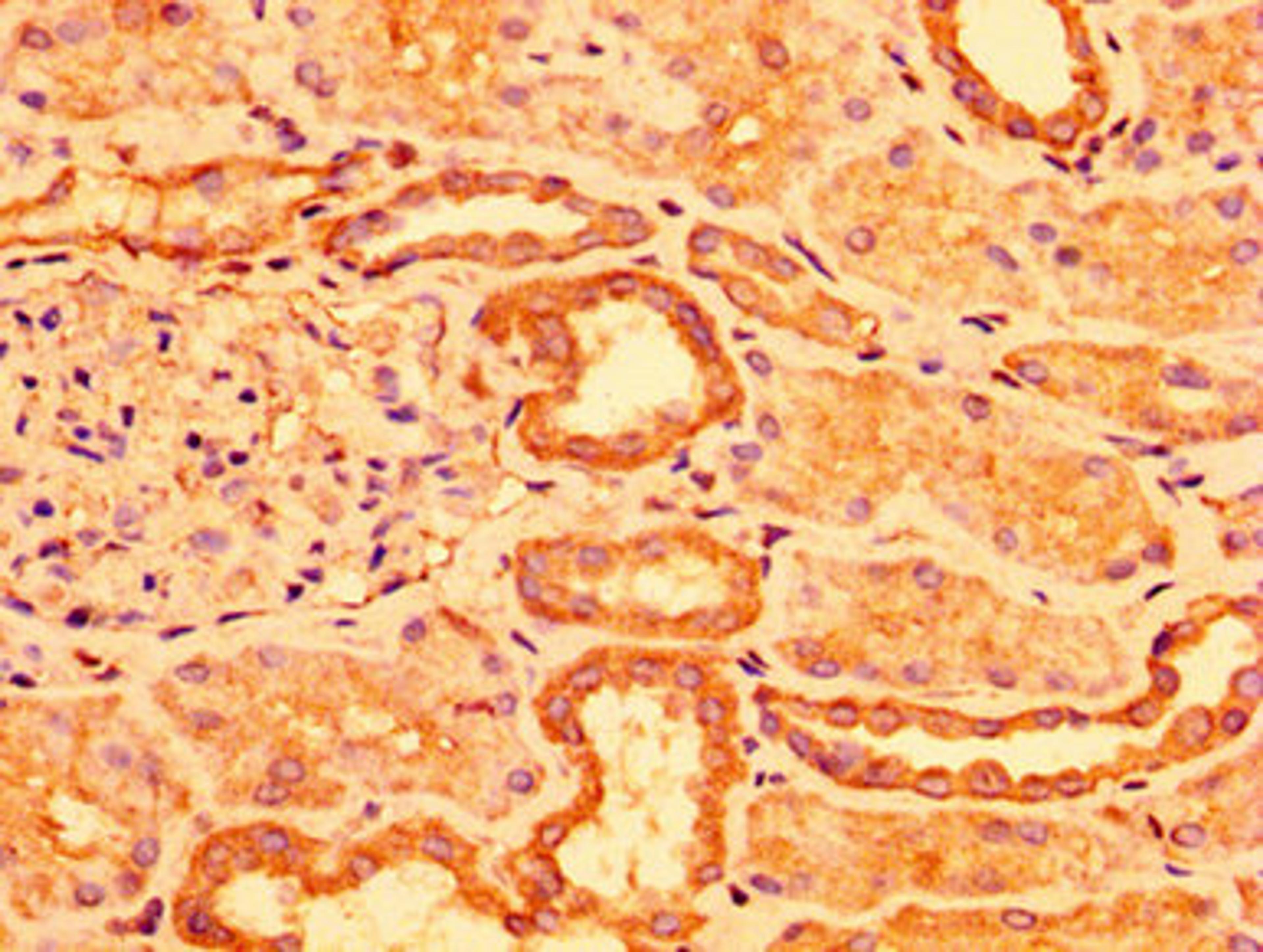 IHC image of CSB-PA768206LA01HU diluted at 1:300 and staining in paraffin-embedded human kidney tissue performed on a Leica BondTM system. After dewaxing and hydration, antigen retrieval was mediated by high pressure in a citrate buffer (pH 6.0). Section was blocked with 10% normal goat serum 30min at RT. Then primary antibody (1% BSA) was incubated at 4°C overnight. The primary is detected by a biotinylated secondary antibody and visualized using an HRP conjugated SP system.