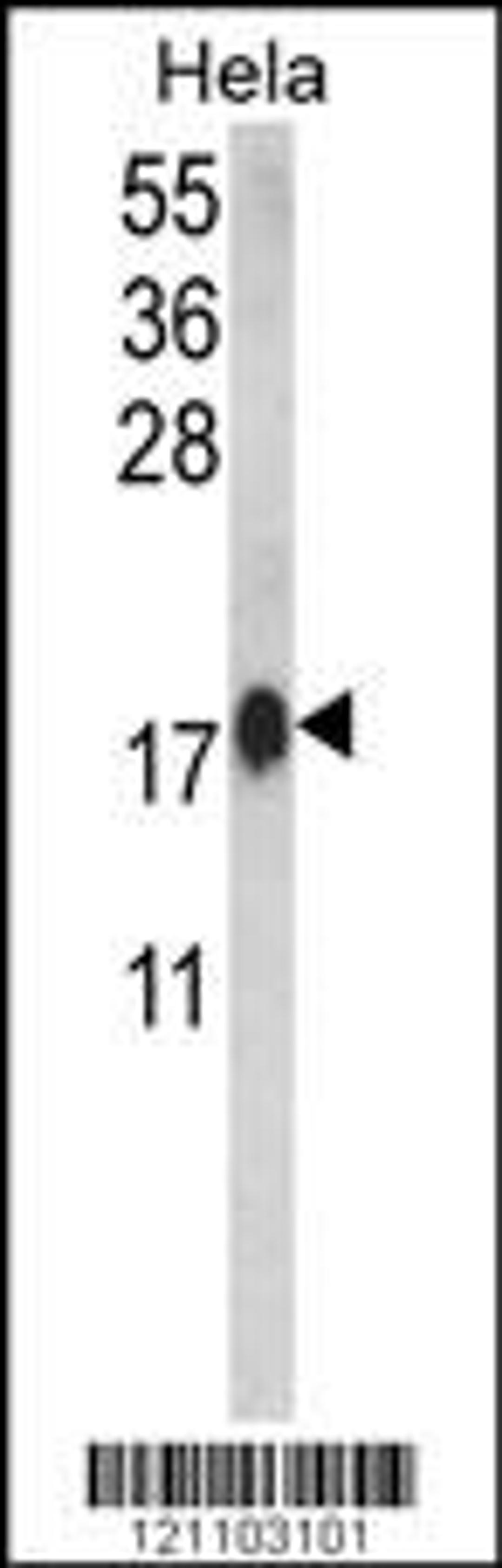 Western blot analysis of CALM1 Antibody in Hela cell line lysates (35ug/lane)(2ug/ml)