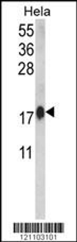 Western blot analysis of CALM1 Antibody in Hela cell line lysates (35ug/lane)(2ug/ml)