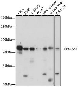 Western blot - RPS6KA2 antibody (A16305)