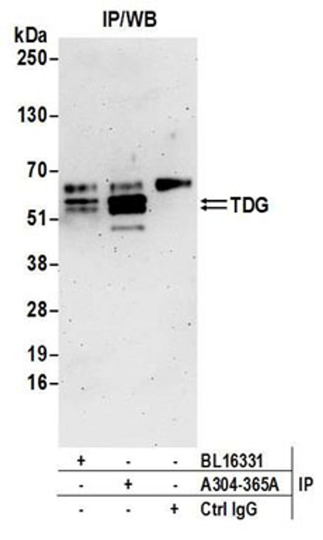 Detection of human TDG by western blot of immunoprecipitates.