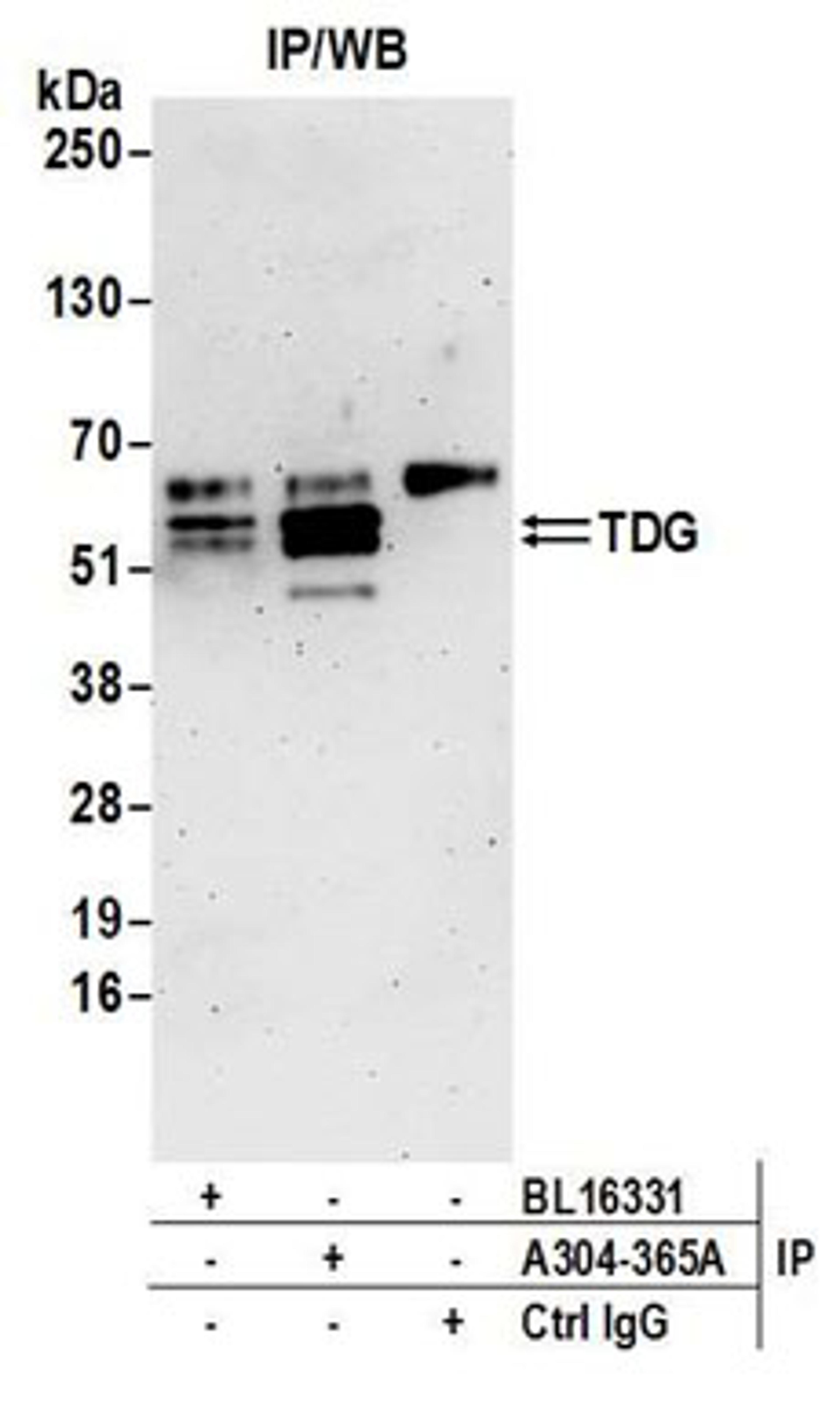 Detection of human TDG by western blot of immunoprecipitates.