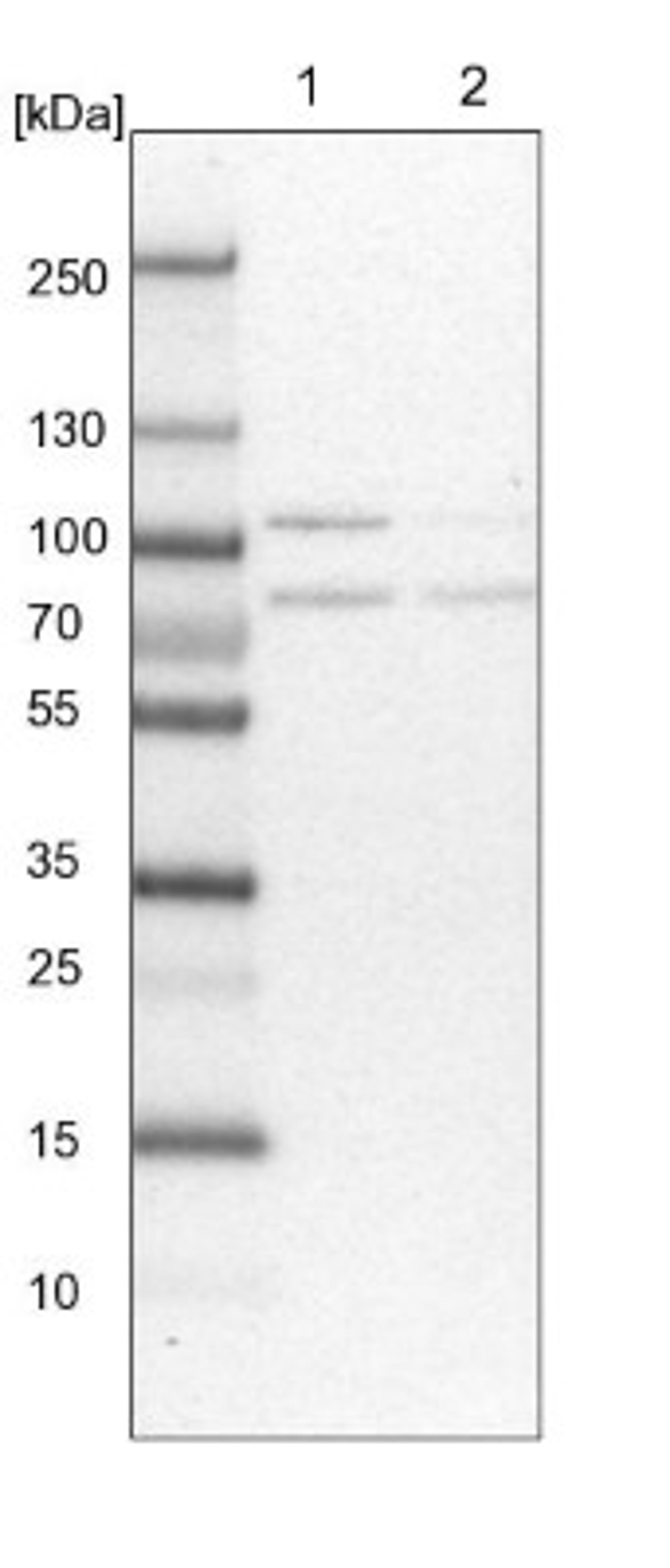 Western Blot: PKC iota Antibody [NBP1-84959] - Lane 1: NIH-3T3 cell lysate (Mouse embryonic fibroblast cells)<br/>Lane 2: NBT-II cell lysate (Rat Wistar bladder tumour cells)