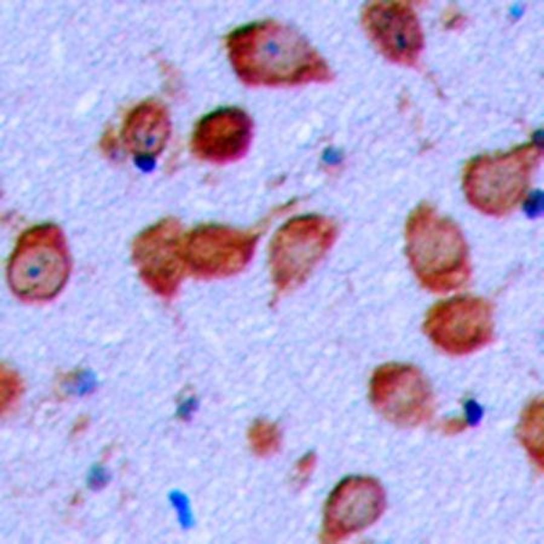 Immunohistochemical analysis of formalin-fixed and paraffin-embedded human brain tissue using EPHA6 antibody