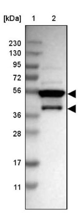 Western Blot: MRS2 Antibody [NBP2-34200] - Lane 1: Marker [kDa] 230, 130, 95, 72, 56, 36, 28, 17, 11<br/>Lane 2: Human cell line RT-4