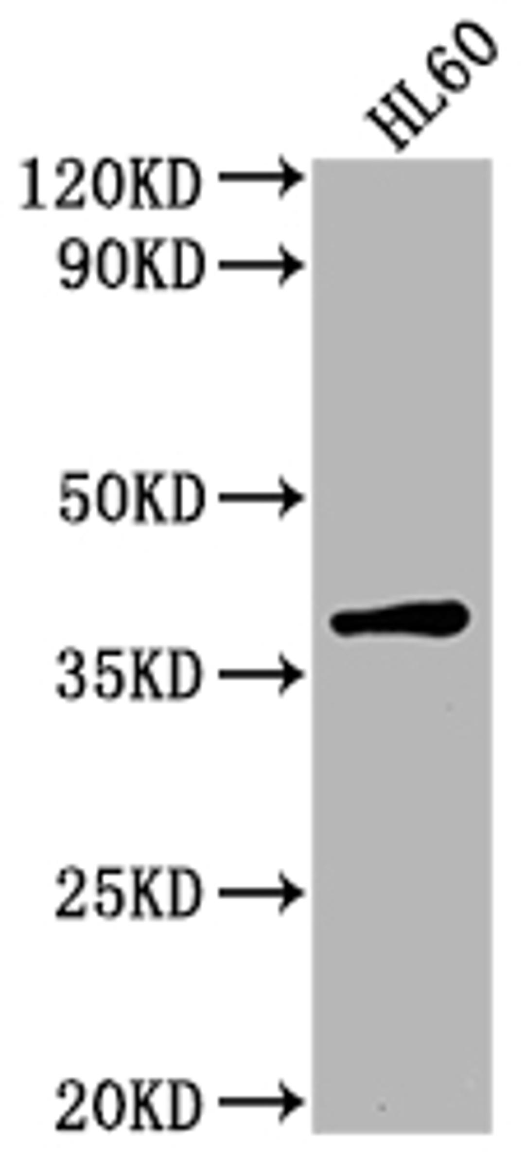 Western Blot. Positive WB detected in: HL60 whole cell lysate. All lanes: TCF19 antibody at 1:2000. Secondary. Goat polyclonal to rabbit IgG at 1/50000 dilution. Predicted band size: 38 kDa. Observed band size: 38 kDa. 
