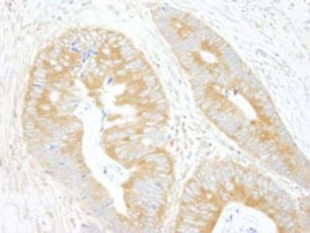 Detection of human eIF3A/eIF3S10 by immunohistochemistry.