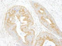 Detection of human eIF3A/eIF3S10 by immunohistochemistry.