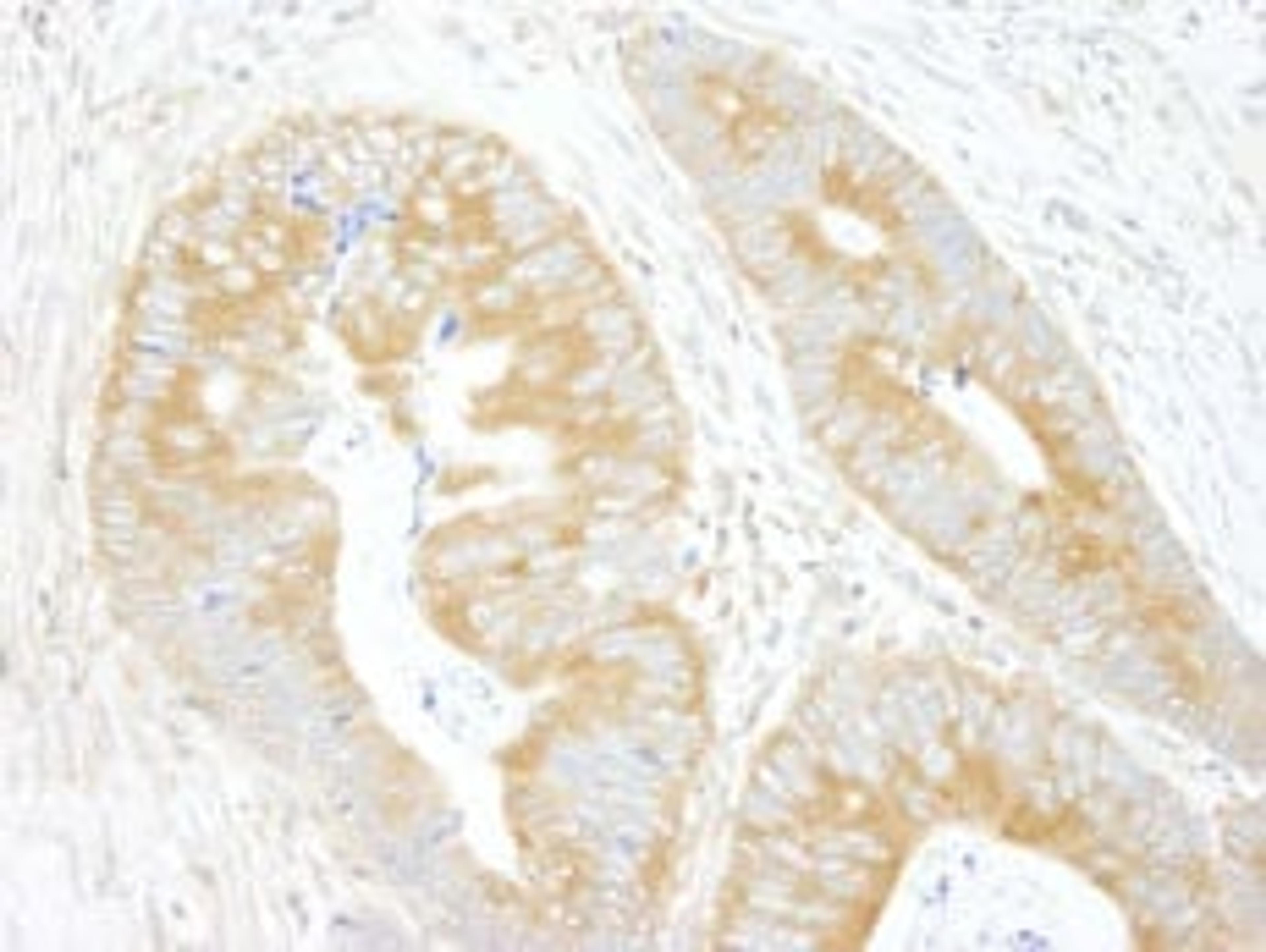 Detection of human eIF3A/eIF3S10 by immunohistochemistry.